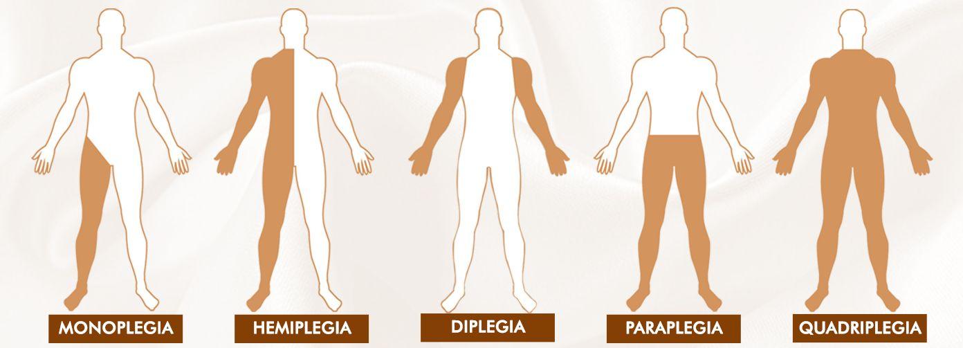 Treatment For Paralysis A Step Closer | Pcsrf | To Cure Paralysis For All